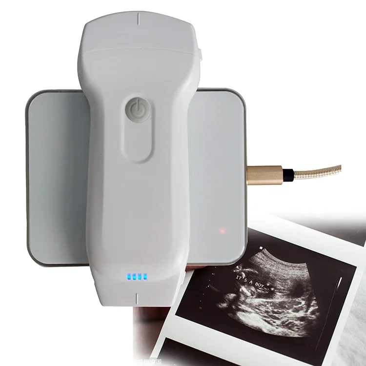 

Highest Cost-Effective Double Probes Wireless Color Doppler Ultrasound Scanner Wireless Linear Ultrasound Probe