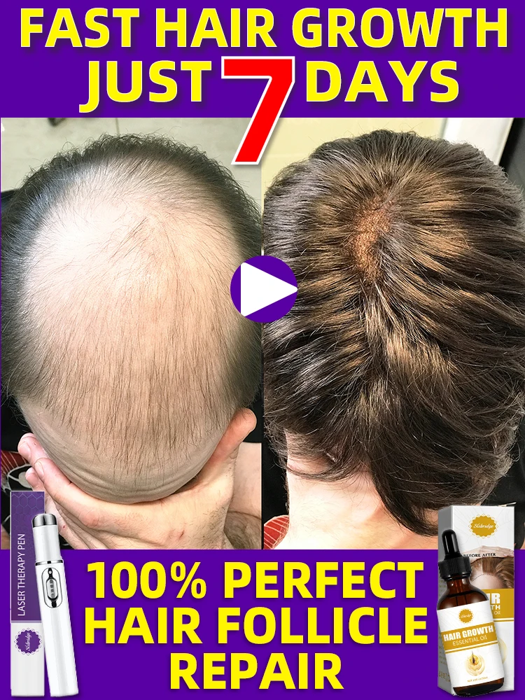 

99% of buyers buy again, have more and more hair, say goodbye to baldness, thick hair,Hot selling product