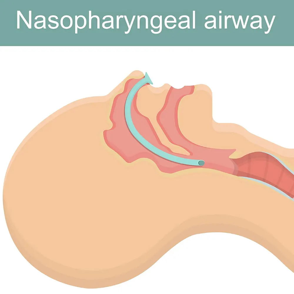 

1Pc 7mm Disposable Medical Nasopharyngeal Airway Nasopharyngeal Duct Nasal Airway Tube Health Care for Unconscious Patients