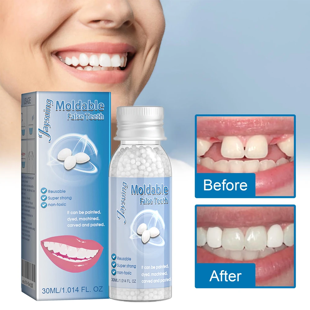 Resin Tooth Repair Glue Shapeable Teeth Gaps Filling Solid Glue Temporary Teeth Repair Falseteeth Glue Safety Dental Supplies