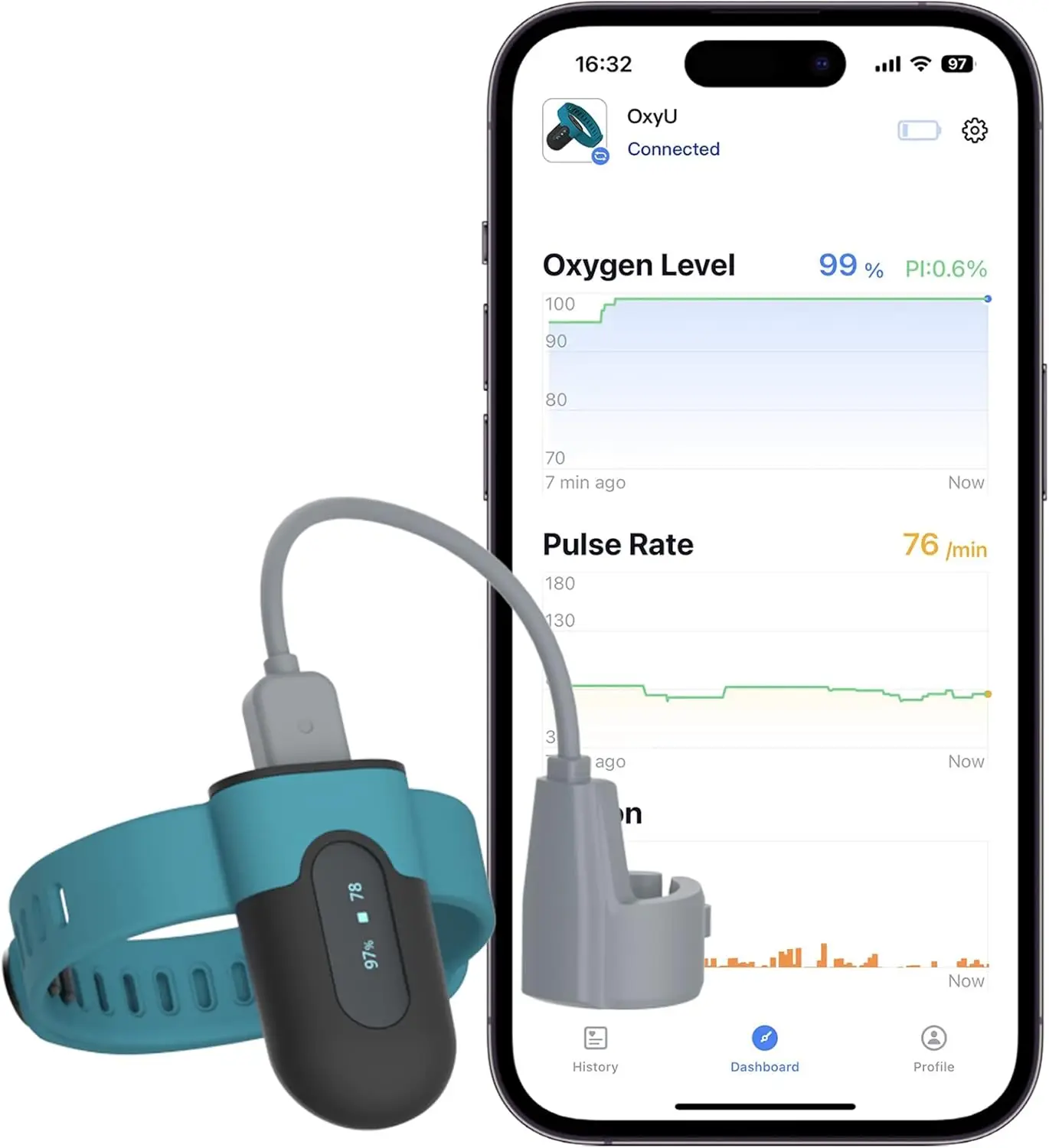 Wearable Blood Oxygen Monitor with Finger Sensor | Heart Rate & Tracking