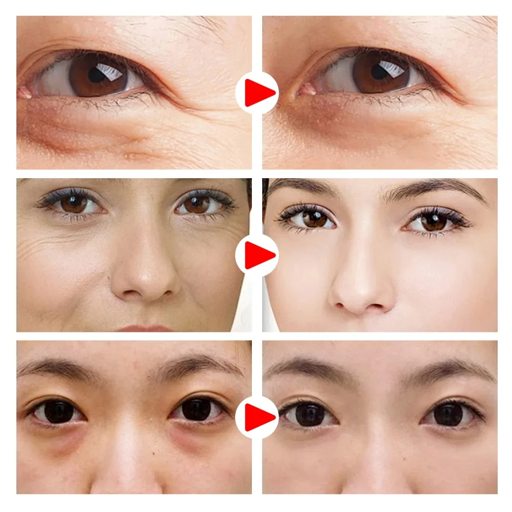 6/4/2 pary kolagenowych maseczek pod oczy, usuwających cienie pod oczami, nawilżających, ujędrniających, liftingujących, redukujących drobne linie, pielęgnujących skórę okolicznej.