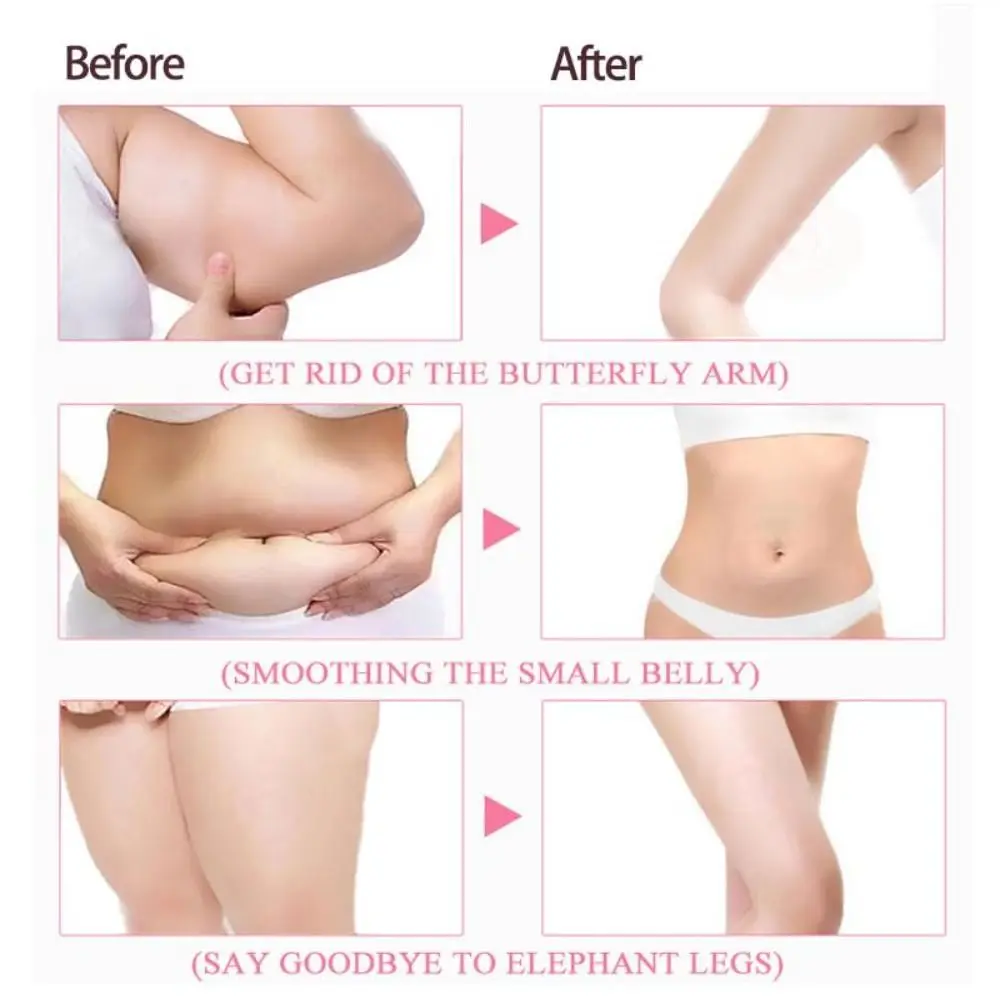 ลดไขมันส่วนเกิน ครีมกระชับสัดส่วน กระชับผิวที่หย่อนคล้อย ขจัดอาการบวมน้ำในร่างกาย ครีมบำรุงผิวกายให้ความชุ่มชื้น