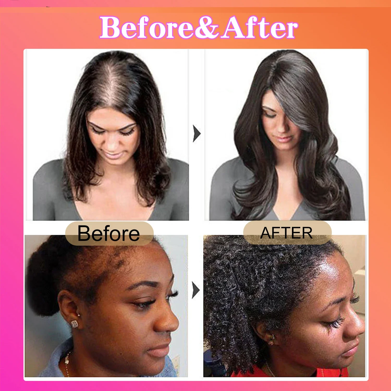 Thumbnail 4 - #57 Compare Hair Loss Treatments Before You Buy