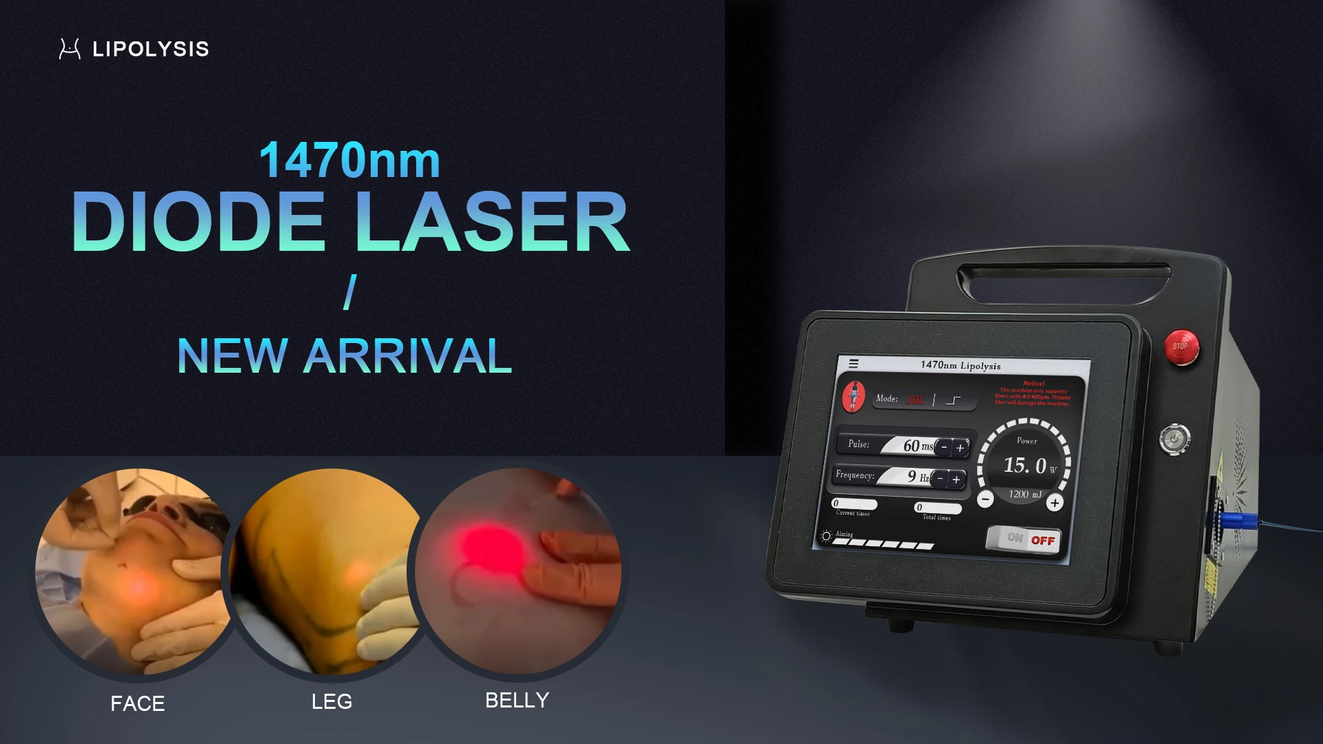 1470 Diode Laser Endoscope For Medical Plastic Surgery 3D Fat Decomposition For Liposuction Plastic Surgery Beauty Equipment