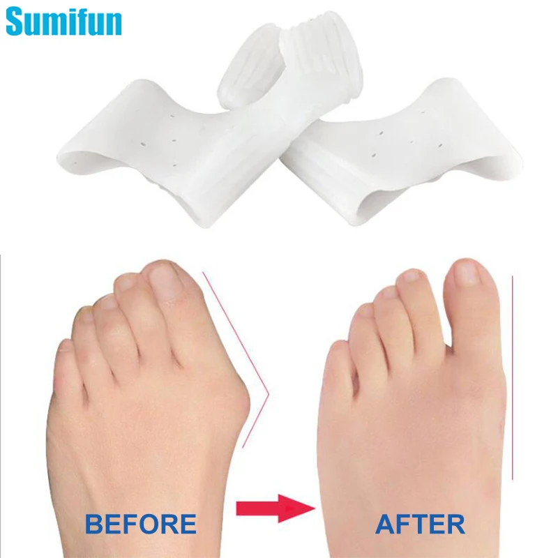 

1Pair Silicone Gel Toe Separator Hallux Valgus Bunion Corrector Hammer Toe Straightener Foot Pain Relief Pedicure Tool Foot Care