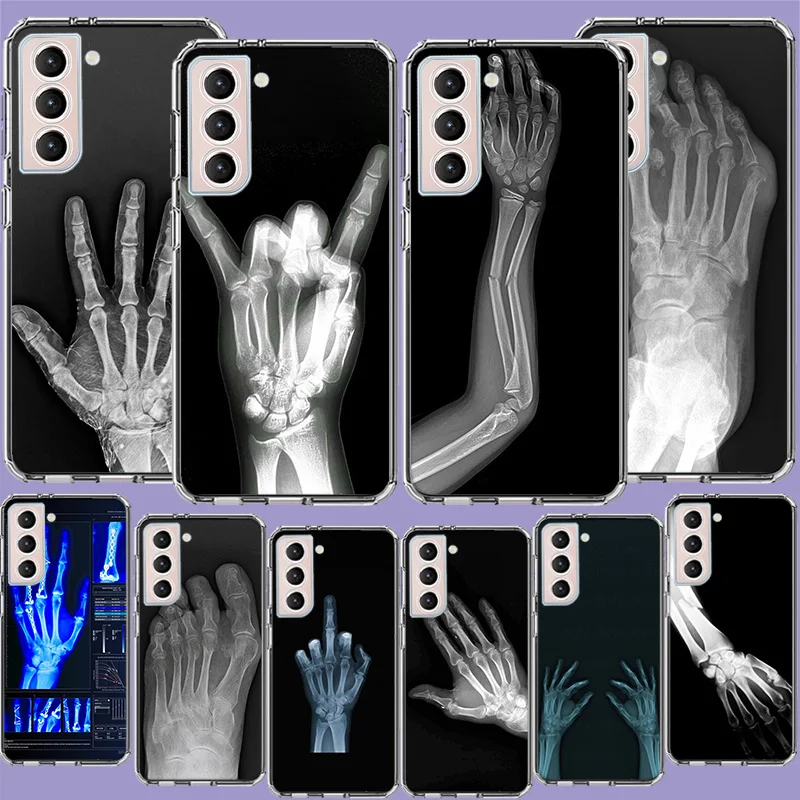 Autumu X ray Hand Bones Phone Case For Galaxy A15 A25 A35 A55 Samsung A10 A20E A30 A40 A50 A70 A11 A21S A31 A41 A51 A71 A9 A8 A7