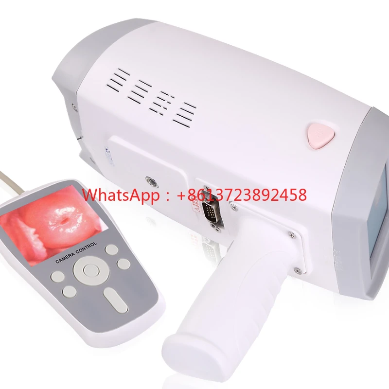 

MY-F005 portable Handheld Gynecology Colposcopy system digital electronic video for women for gynecology