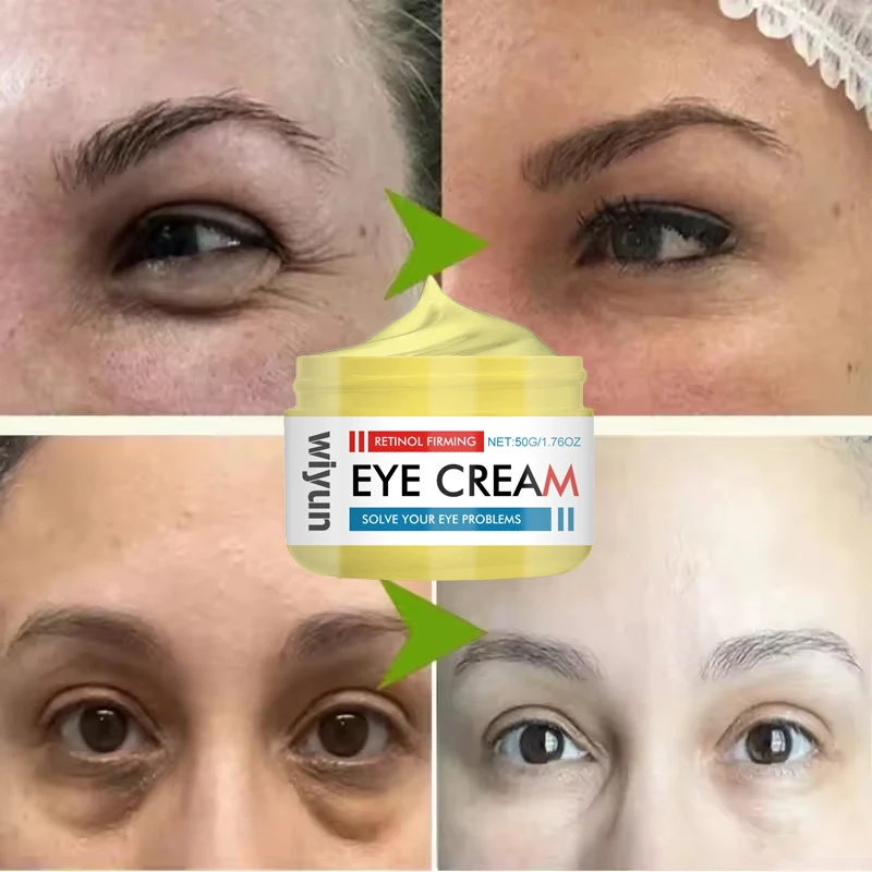 Instant Eye Bag Removal Cream Retinol Anti-Wrinkle Firming Skin Fade Fine Lines Anti Dark Circle Puffiness Brighten Eye Care