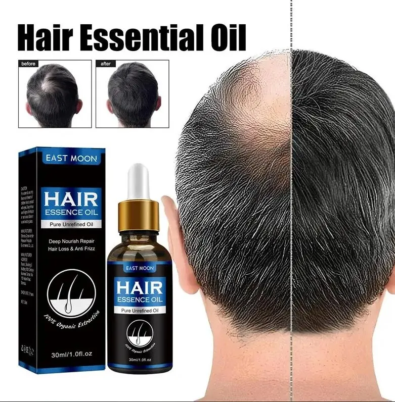 Hair Growth Oil Fast Hair Growth Effective Baldness Repair Hereditary Hair Loss Postpartum Hair Loss Seborrheic Hair Loss Care