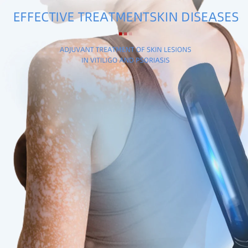 Lampada UVB per terapia Lampada per psoriasi Trattamento della pelle Luce 308NM Strumento per fototerapia vitiligine a banda stretta ultravioletta