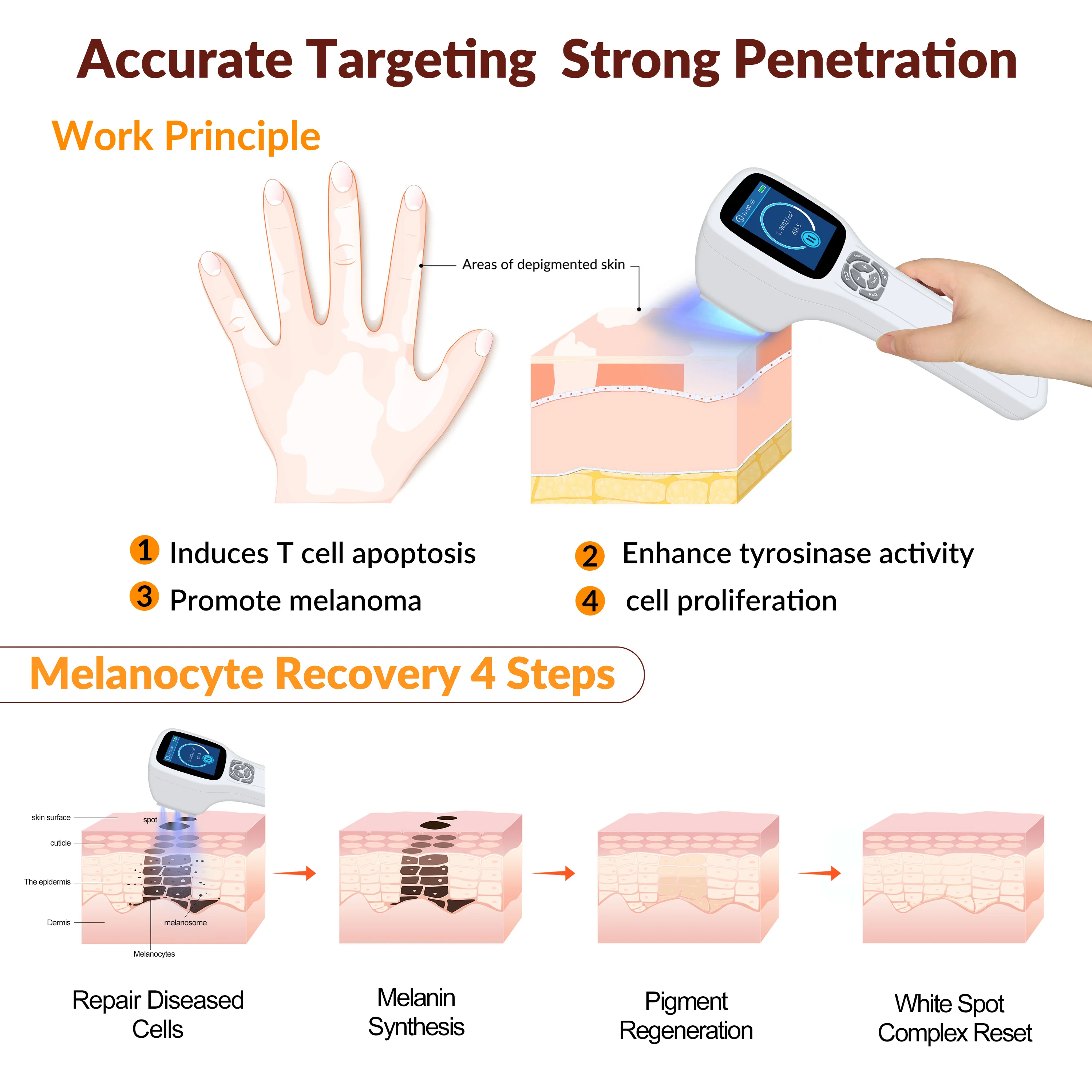 ZJZK Vitiligo On Light Skin At Home 308nmx64diodes UV Light For Psoriasis Amber For Skin Furuncle Alopecia Areata Albinism