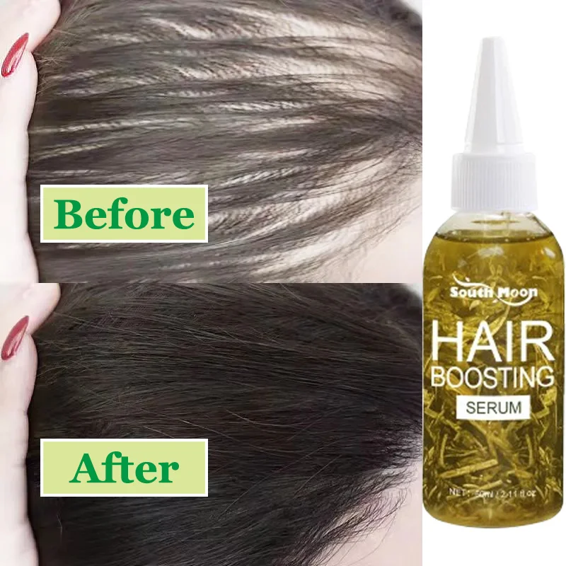 Ginger Hair Growth Serum Anti Hair Loss Baldness Fast Regrowth Hair Care Oil Repair Damaged Hair Scalp Treatment For Women Men