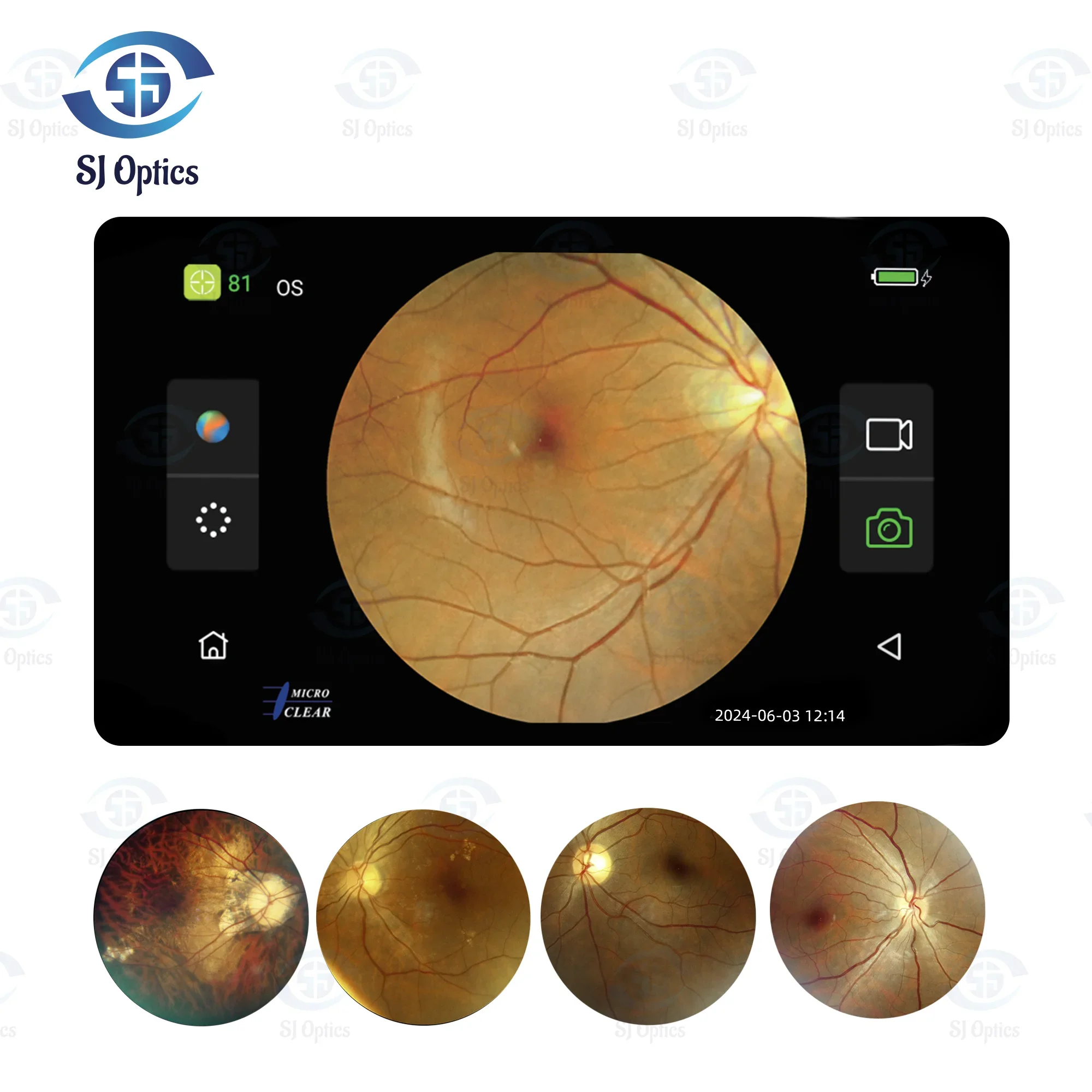 Optical Instrument Ultra Wide Field Fundus Retinal Fundus HFC-02 Ophthalmic Fundus
