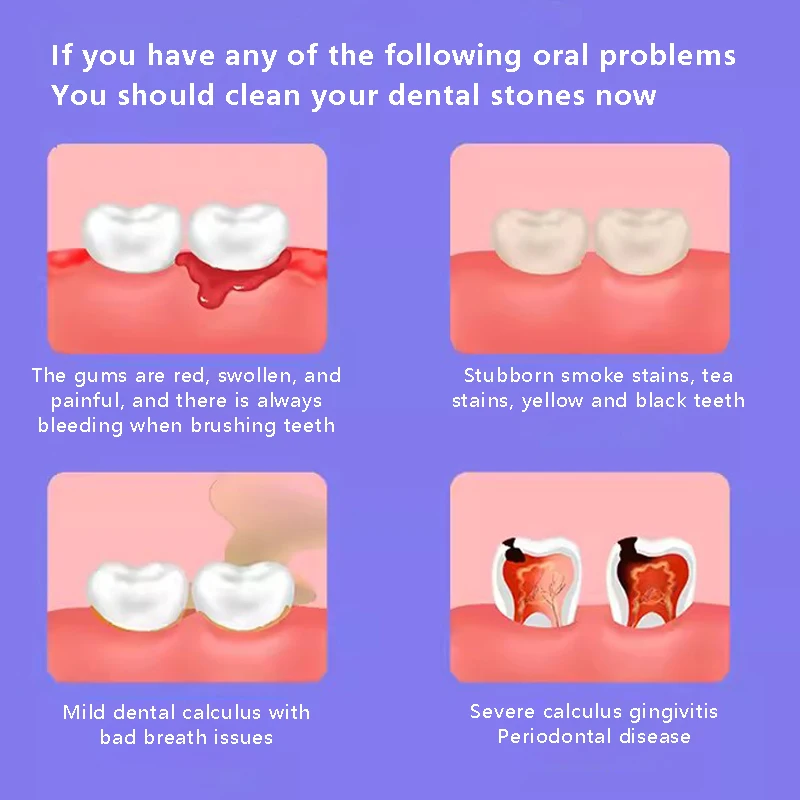 Youpin dr.bei เครื่องทำความสะอาดฟันระบบอัลตราโซนิคใช้ในครัวเรือนถอดแคลคูลัสและหินปูนทำความสะอาดฟัน