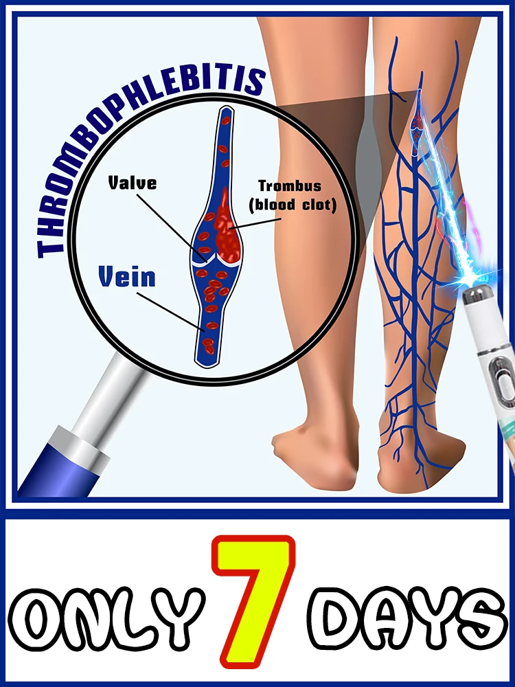 

Varicose vein pain relief, a 2025 hot-selling varicose vein blue light tool set, a leg care tool.