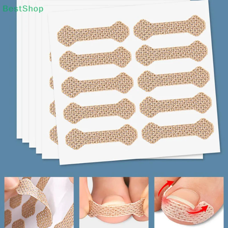 💦Ingrown Toenail Correction Patch 60Pcs,Prevent Ingrown Nails,Anti Nails Into The Flesh Long Toe Pad