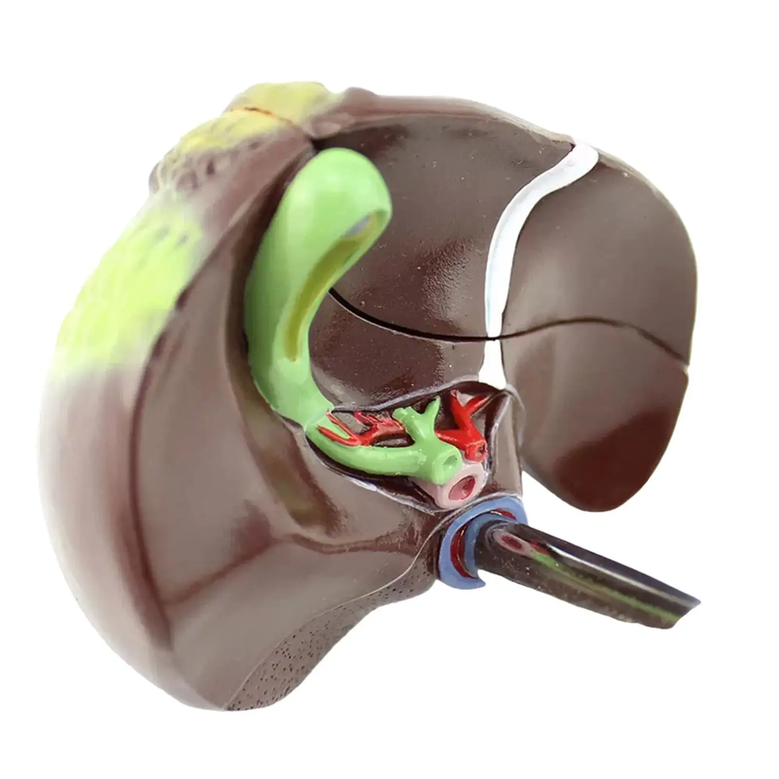 PVC Human Pathological Fatty Liver Cirrhosis Hepatitis Model Medical Teaching Models