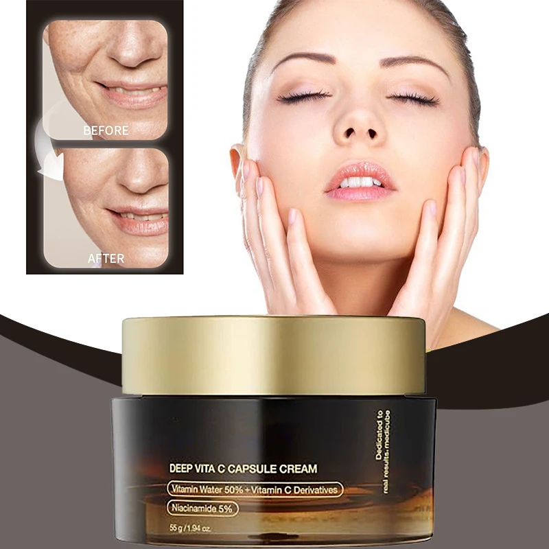 Face Cream Powerful Spot-removing Whiten Vitamin C Cream Brighten Skin Eliminates Melanin Pigmentation Melasma Dark Spots