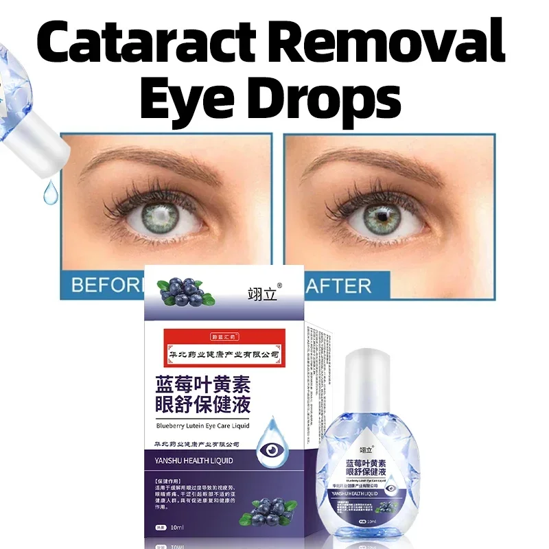 

Cataract Treatment Eye Drops Improve Blurred Vision Eye Discomfort Glaucoma And Presbyopia Removal Blueberry Lutein Eyes Drop