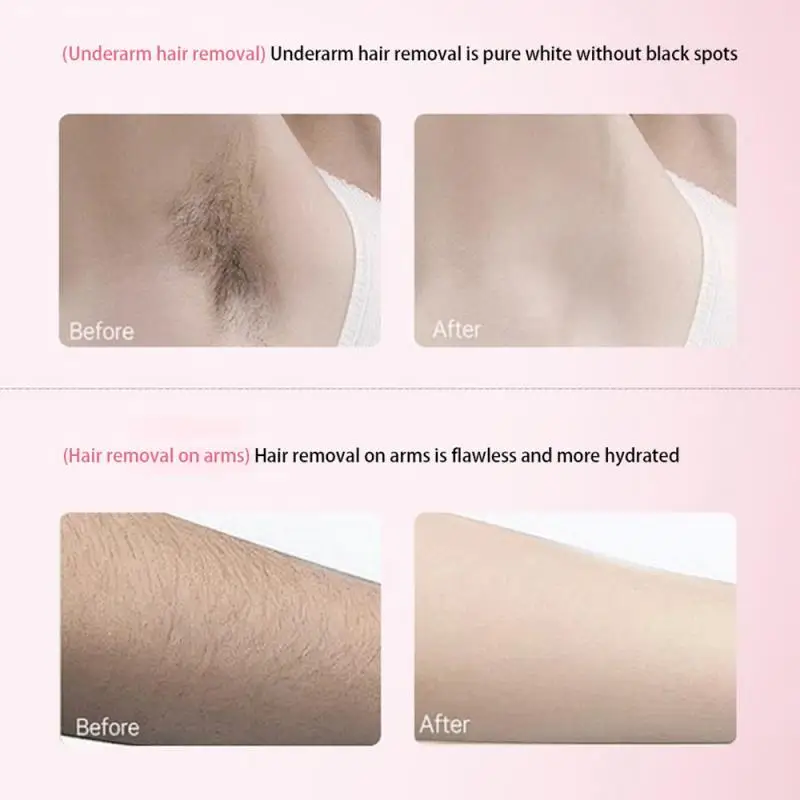 Removal Cream Fast Hair Painless Inhibitor Arm Armpit LegsHair Growth Permanent Depilatory For Men Women Beauty Health Care 60g