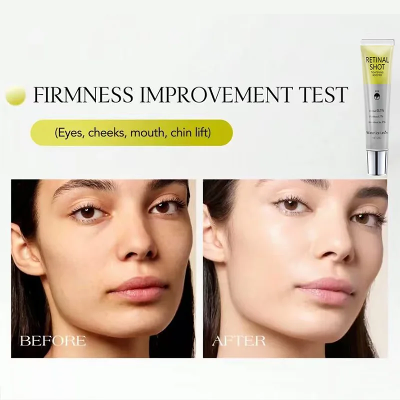 مصل عين معزز لشد الشبكية مع 0.1% شبكية و3% HA لشد البشرة وترطيبها وتنعيم البشرة.