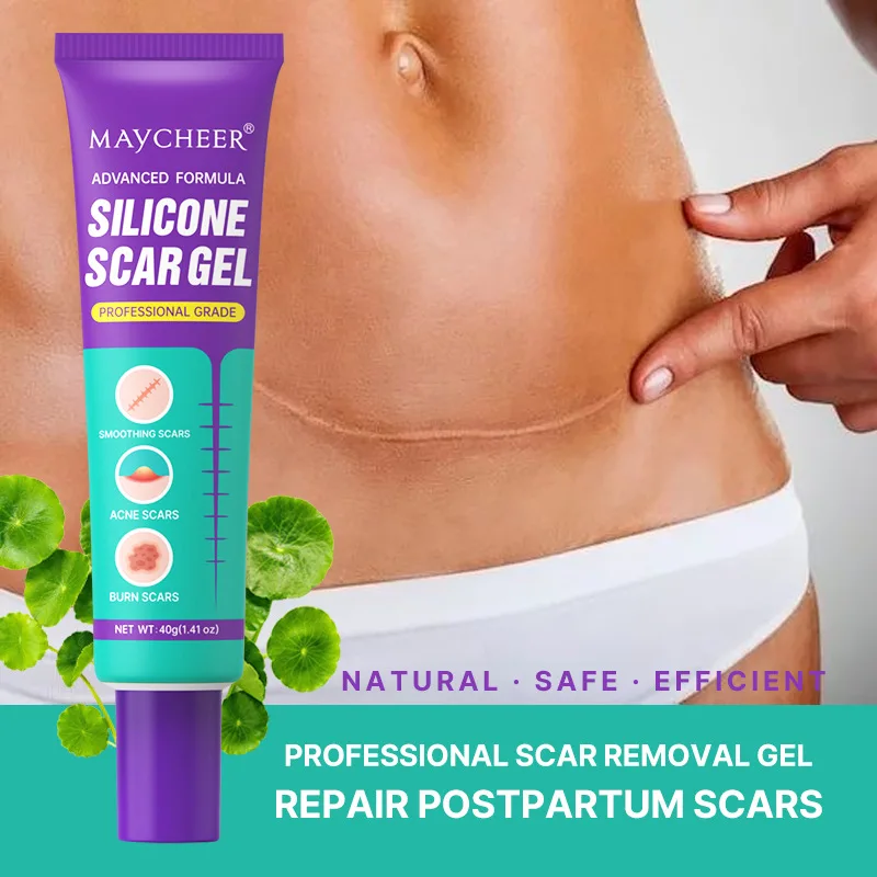 Scar Gel 40g Scar Cream Postoperative Fading Scar Skin Mommy Pattern Ointment