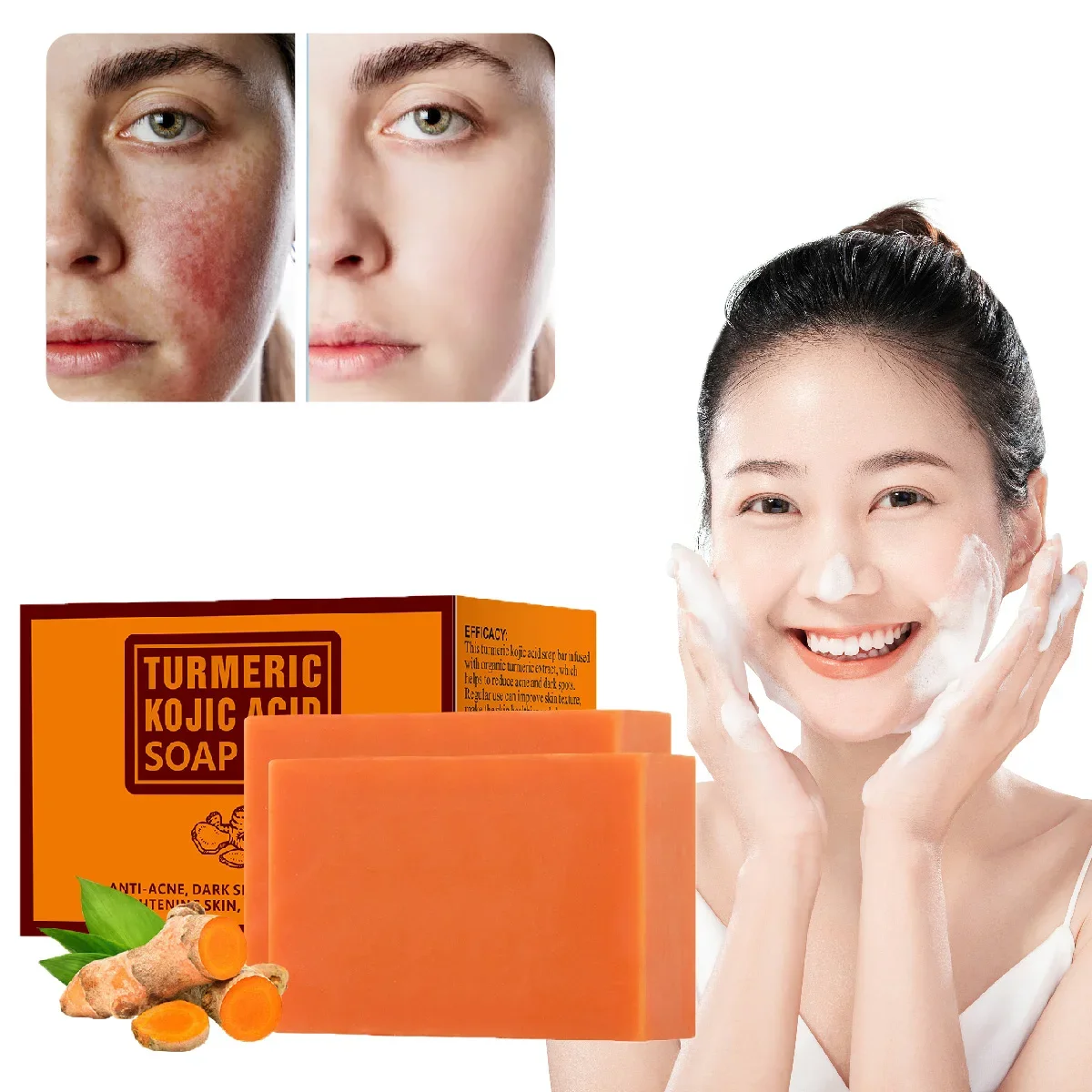 

Turmeric Kojic Acid Soap Bar Handmade Bath Deep Cleaning Anti Acne Dark Spot Remover Brightening Facial Cleansing Skin Care