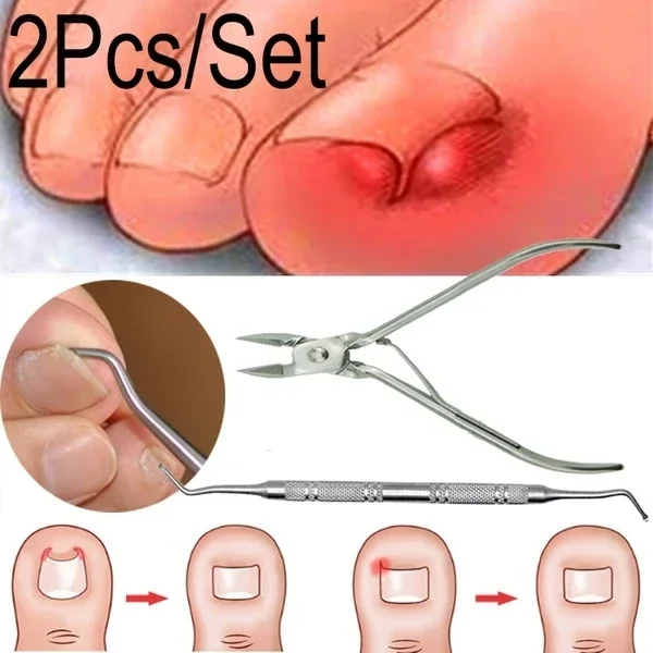 

2Pcs/Set Ingrown Toe Nail Correction Nippers Clipper Cutters Dead Skin Dirt Remover + Paronychia Podiatry Pedicure Care Tool