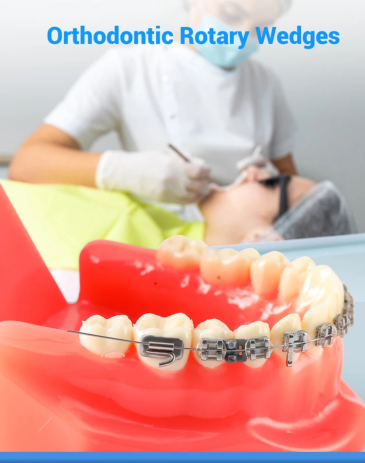 20 sticks AZDENT Dental Kieferorthopädische Rotation Keile Verbrauchsmaterialien Ligatur Rotary Torsion Pad Für Archwire Hosenträger Behandlung – Detail 1