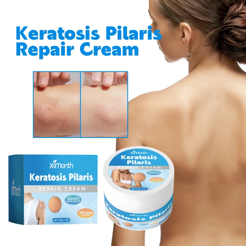 

Keratosis Pilaris Repair Cream - Exfoliate & Hydrate With Urea & Vitamin E, Improve Rough Skin Texture & Brighten Tone