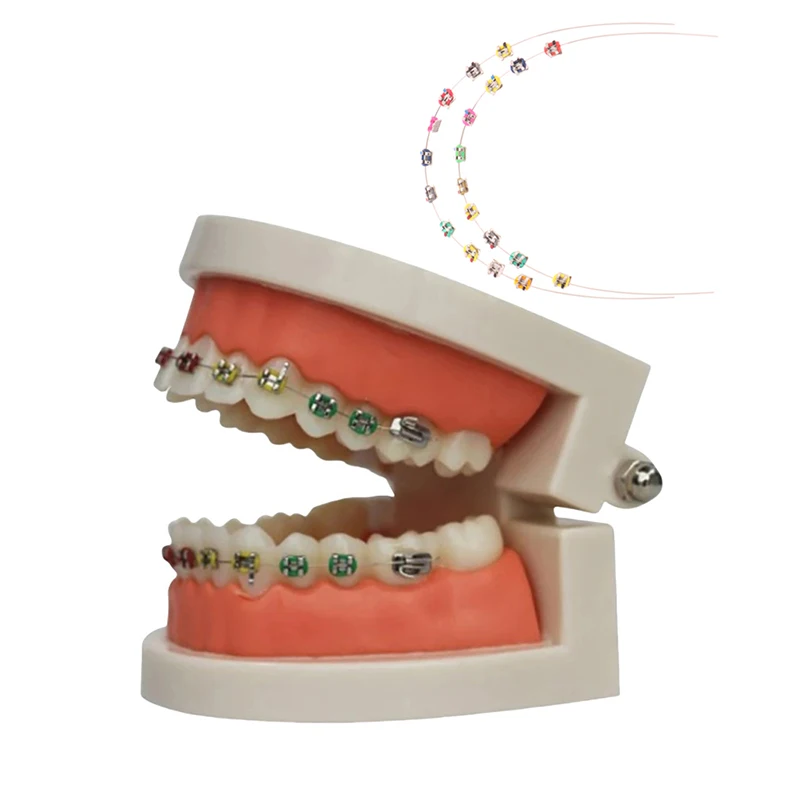 1 Pair Temporary Tooth Decoration With Metal Wires Colorful Metal Bracket And Orthodontic Ligature Ties Dental Decorations