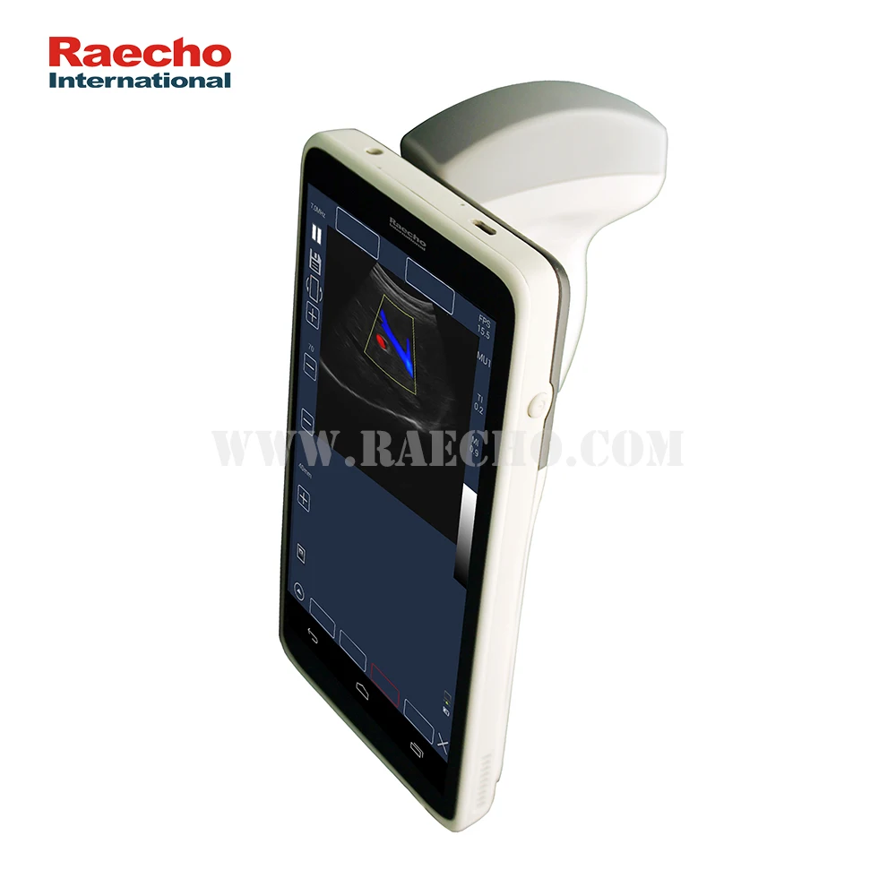 Mini Handheld Wireless Scanner Ultrasound with Good Price