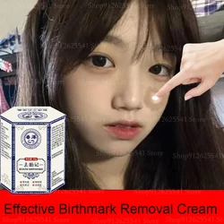 Birthmark Removal Cream Whitening Freckles Cream Facial Spots Skin Dark Spot Remover Melanin Anti-Pigmentation Improve Dullness