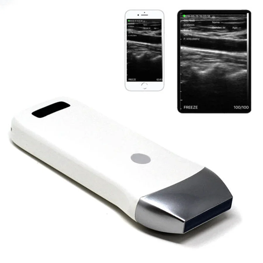 Wireless WiFi Mini Handheld Ultrasound Machine / Ultrasound Scanner Probe B/M