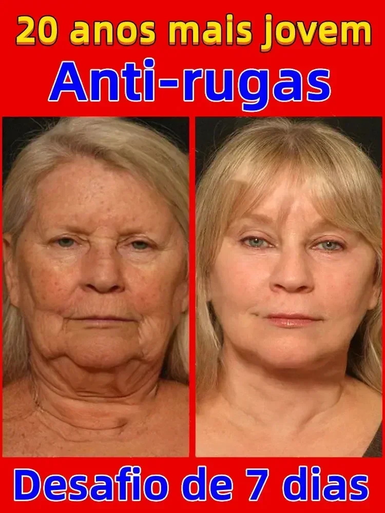 Rosto hidratante anti envelhecimento soro anti-rugas soro facial remover rugas linhas finas ao redor dos olhos corvo pés pescoço rugas