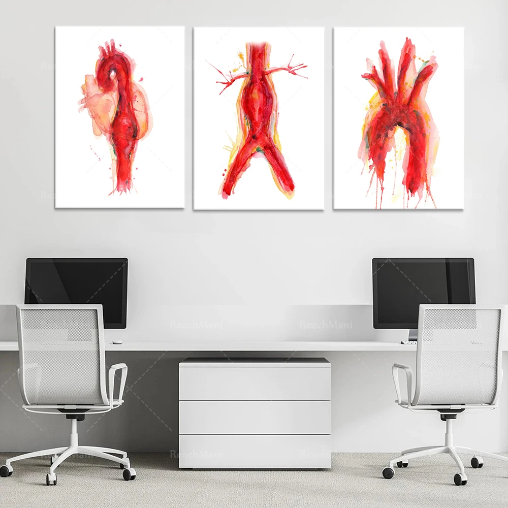 Cardiovascular Watercolor Art Print - Abdominal Aneurysm, Aorta and Thoracic Aneurysm - Anatomy Art Print Poster