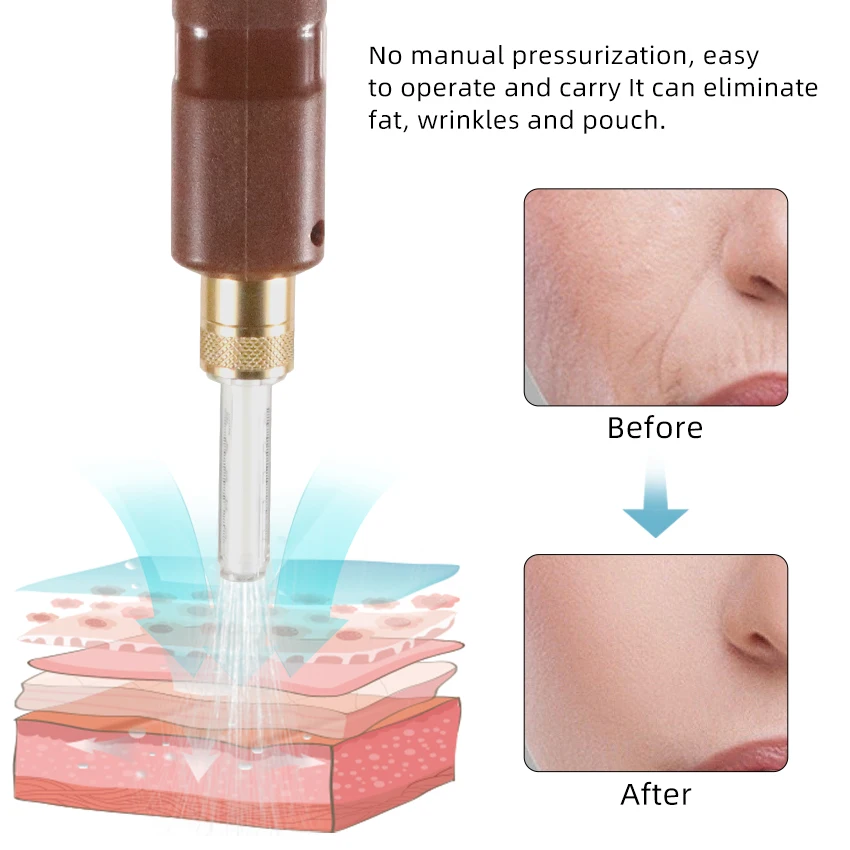 قلم حقن كهربائي بحمض الهيالورونيك ، طقم قلم شفاه احترافي ، ملء بدون إبرة ، ضباب مستمر #3