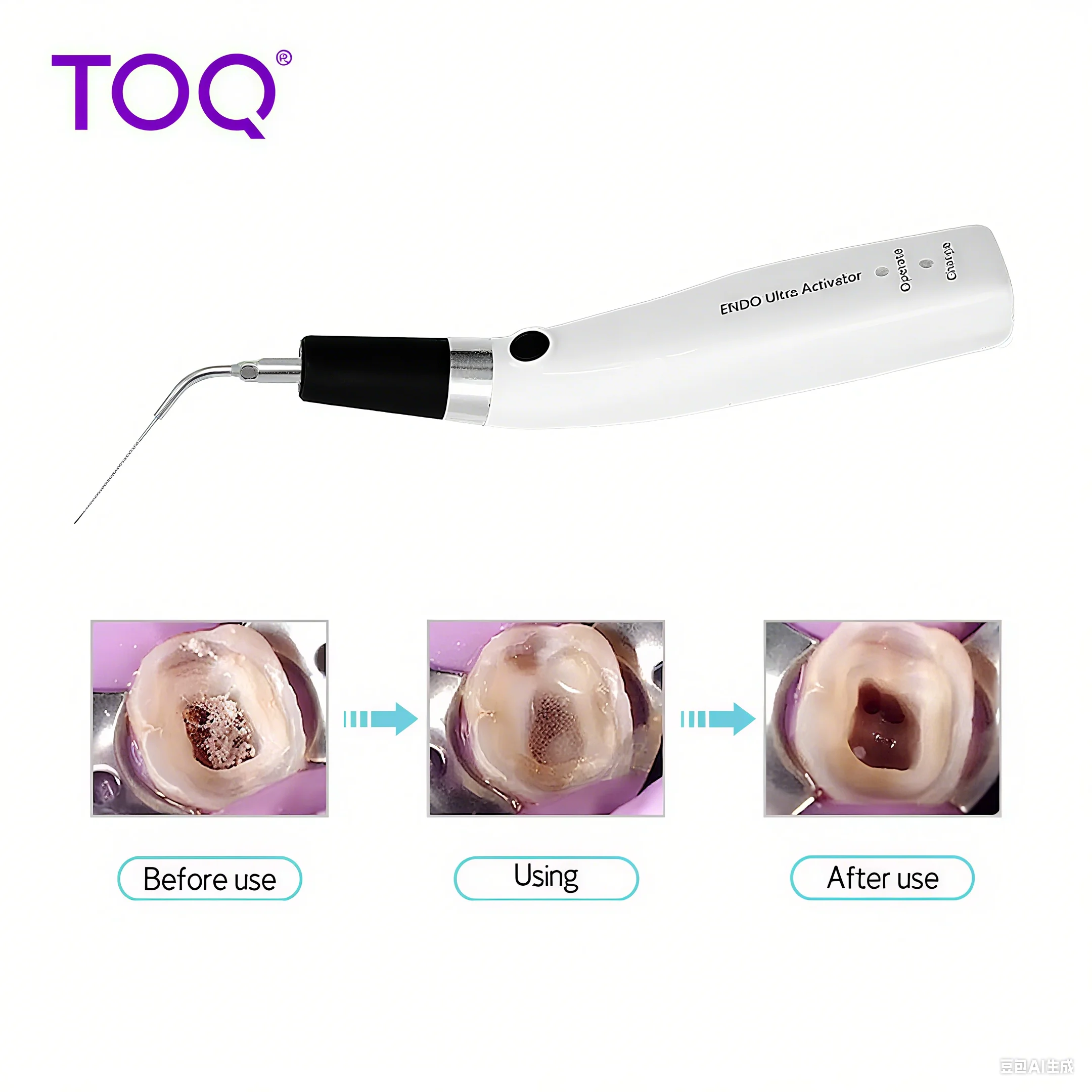 Dental Endo Ultra Activator Endo Irrigator Cordless Ultrasonic Activator With 6 Tips 40-50Khz 1500mAh For Endodontic Treatment