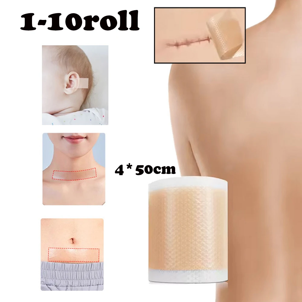 

Silicone 0.5m/Roll Baby Ear Corrector Infant Protruding Ears Correction Kids Ear Aesthetic Correctors Patch Sticker Ear Care
