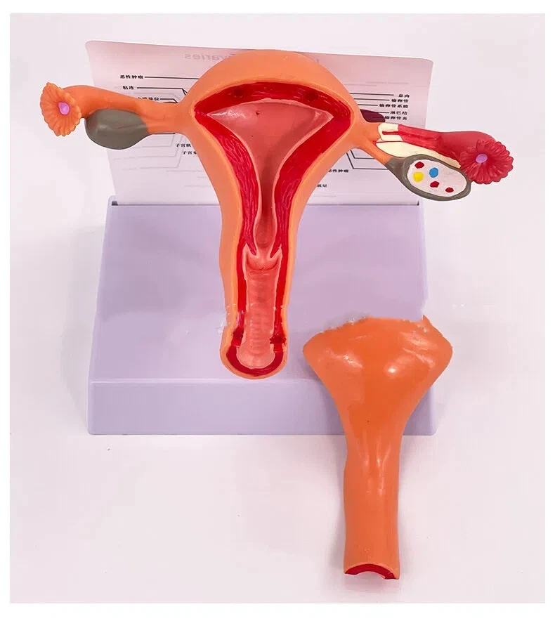 Human uterus model teaching tool mold ovarian anatomy pathology medical model