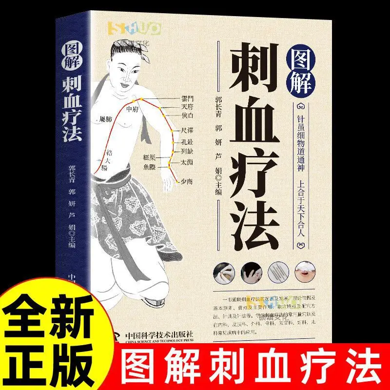 

Illustrated Blood Stimulating Therapy, Detailed Explanation of Meridian Points in The Human Body, Traditional Chinese Medicine