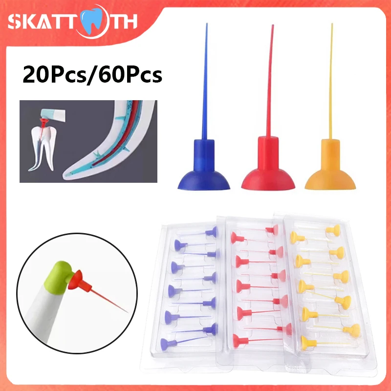 

Dental Endo Sonic Irrigator Tips Activator Tips For Root Canal Treatment Cleaning Blue/Red/Yellow Dentistry Endodontics Tools