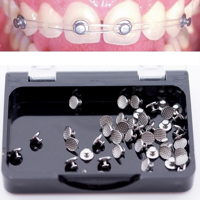 

50pcs/Box Dental Orthodontics Lingual Button Metal Clear Ceramic Composite Mesh Point Base Buttons Orthodontia Material