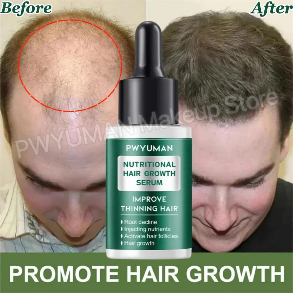 

Fast Hair Growth Serum Anti Hair Loss Essential Oil Prevent Baldness Scalp Treatment Nourish Repair Damaged Regrowth Hair Care