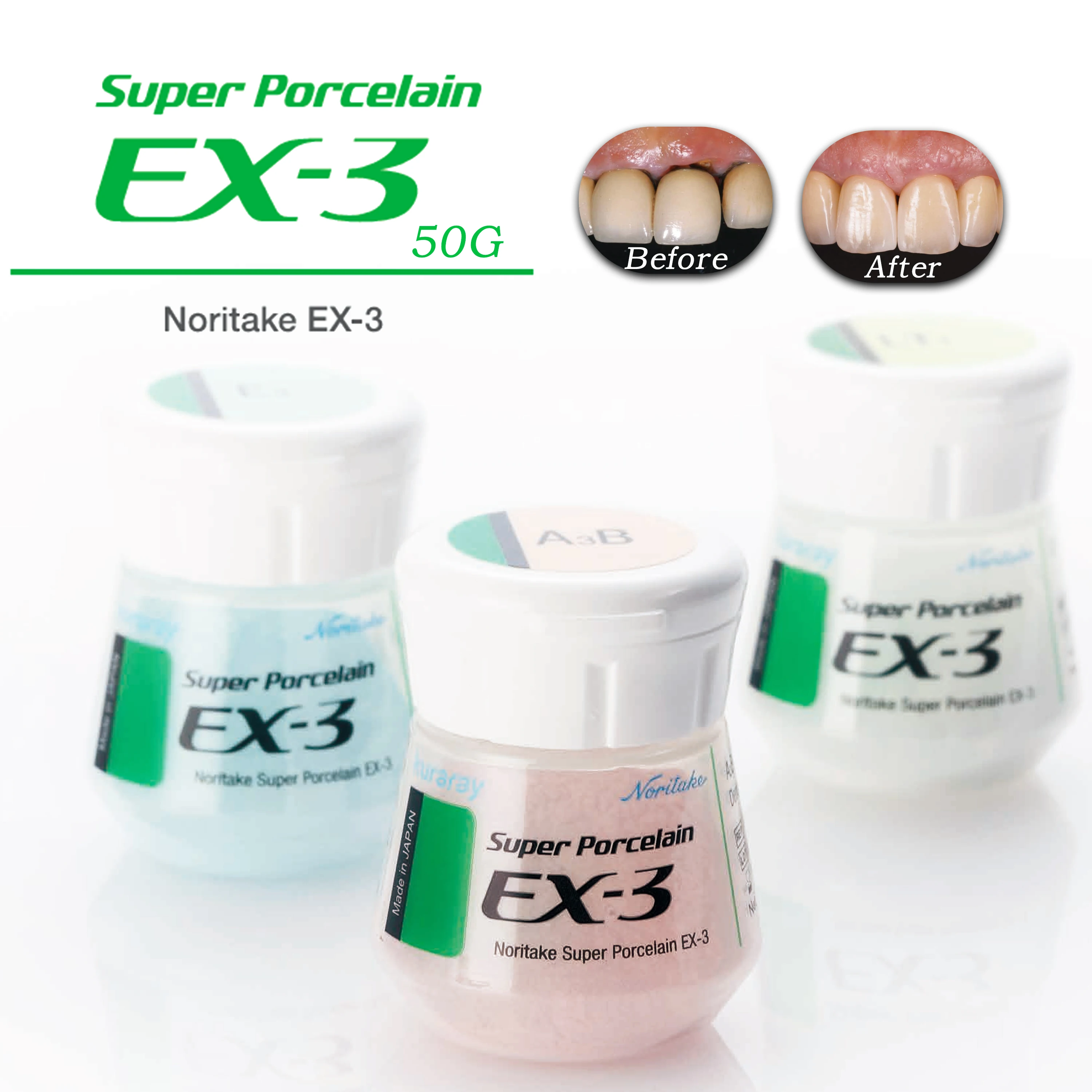 Noritake EX-3 Super Body Porcelain Powder 50g Multi Shades A1B A2B E2 TX PFM Crown Bridge Ceramic Restoration Material