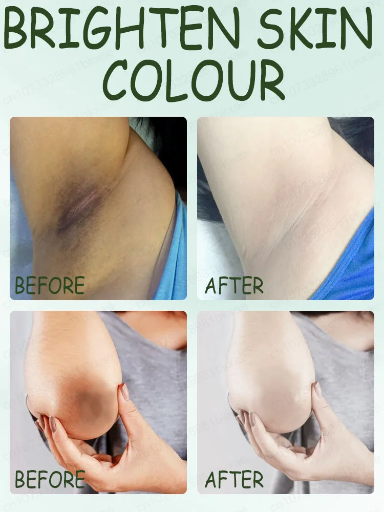 Eliminate melanin in the knees, armpitsneck and inner thighs