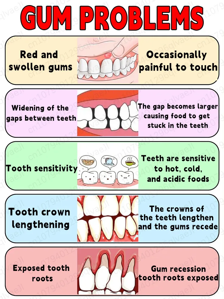 เอสเซนส์ป้องกันฟันผุ ฟื้นฟูเคลือบฟัน ซ่อมแซมฟัน เสริมสร้างความแข็งแรง ซ่อมแซมฟันผุ