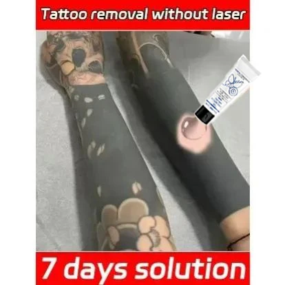 

Tattoo Removal Gel Dissolve Tattoo Repair Skin Moisturizing Painless Deep Cleansing Care gel
