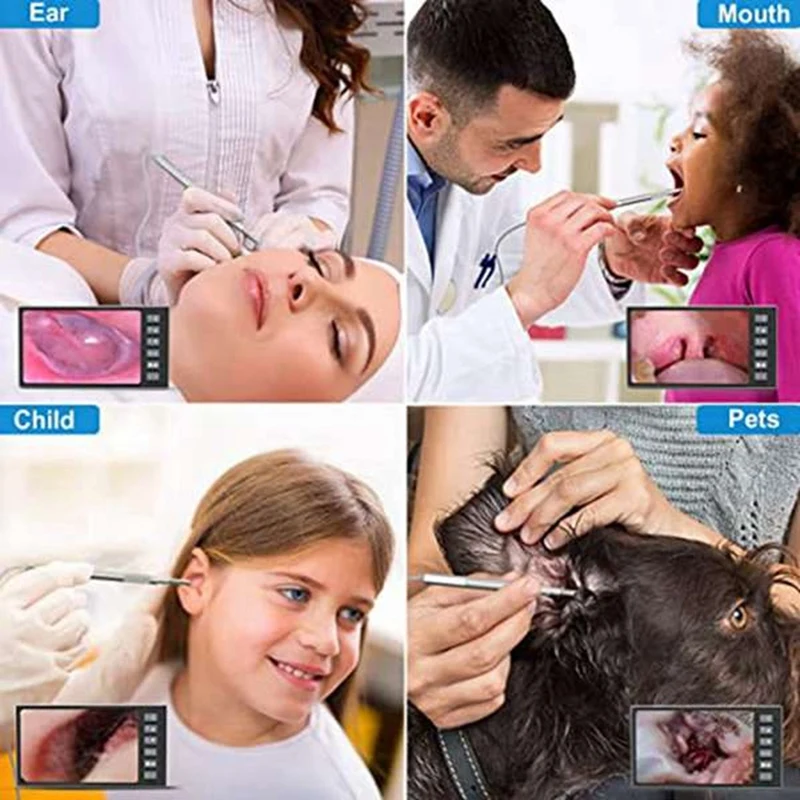 Digital Otoscope With 7-Inch Screen, Ear Camera, Visual Ear Scoop Supports Photo Snapshots And Video Recording,Ear Scoop Durable